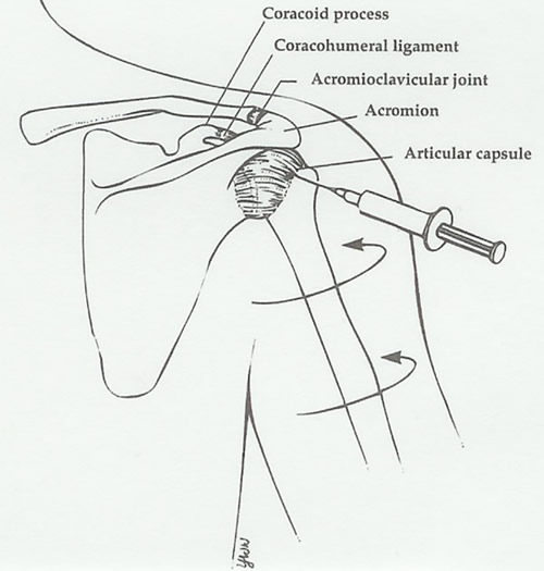 Dr. John E. Prolotherapy Vancouver BC Naturopathic